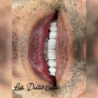 بهترین مرکز ایمپلنت تهران