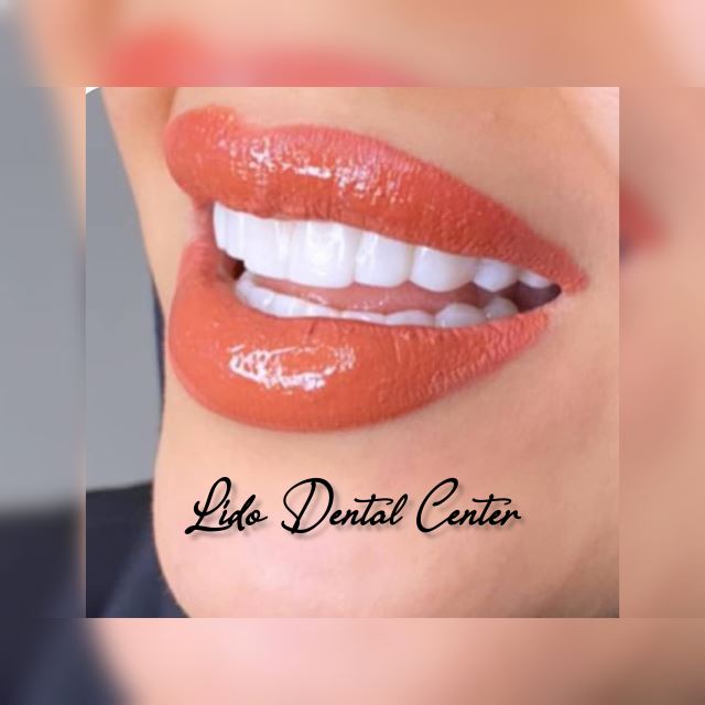 بهترین مرکز ایمپلنت تهران