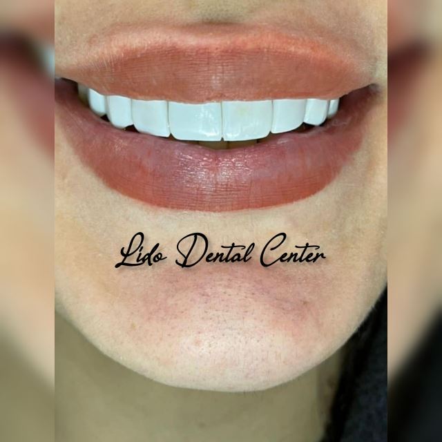 بهترین مرکز ایمپلنت تهران