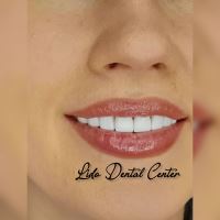 لمینت اقساطی تهران