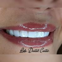 لمینت اقساطی تهران