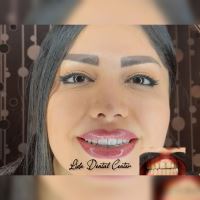 لمینت اقساطی تهران