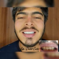 لمینت اقساطی تهران