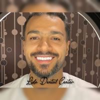 لمینت اقساطی تهران