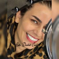 لمینت اقساطی تهران