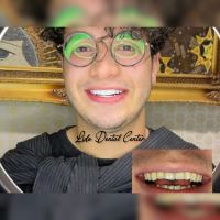 لمینت اقساطی تهران