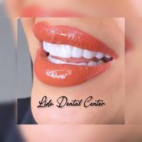 لمینت اقساطی تهران