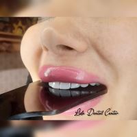 لمینت اقساطی تهران