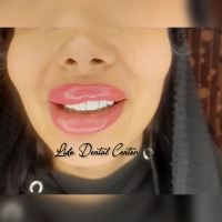 لمینت اقساطی تهران