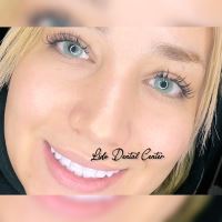 لمینت اقساطی تهران