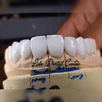 لمینت اقساطی تهران