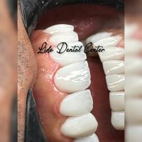 لمینت اقساطی تهران