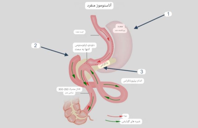 بهترین جراح اسلیو 