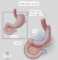 بهترین جراح اسلیو