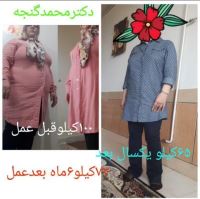 بهترین جراح معده تهران