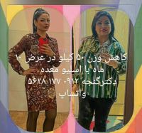 جراح بای پس معده تهران