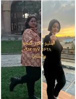 جراح معده تهران