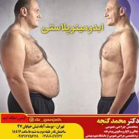 قیمت بوتاکس معده تهران