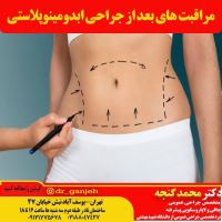 جراحی لاپاراسکوپی معده تهران