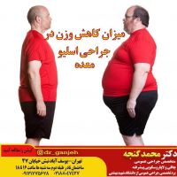 بهترین جراح اسلیو معده تهران