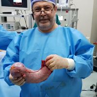 متخصص جراح معده تهران