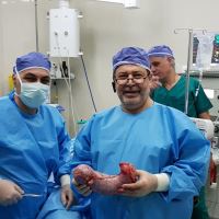 بوتاکس معده تهران