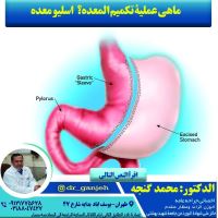 قیمت بوتاکس معده تهران