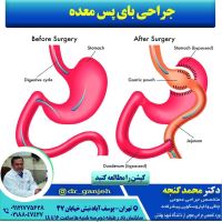 جراح لاپاراسکوپی معده تهران