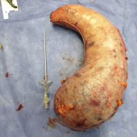 بهترین جراح چاقی در تهران ( کاهش وزن تضمینی )