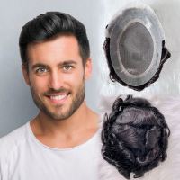 بهترین پروتز مو در کرج