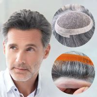 بهترین پروتز مو در کرج