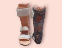 اسکن کف پا در پیروزی