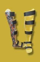 اسکن کف پا در پیروزی