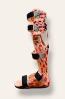 اسکن کف پا در پیروزی