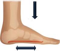 اسکن کف پا در غرب تهران