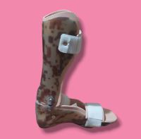 اسکن کف پا در غرب تهران