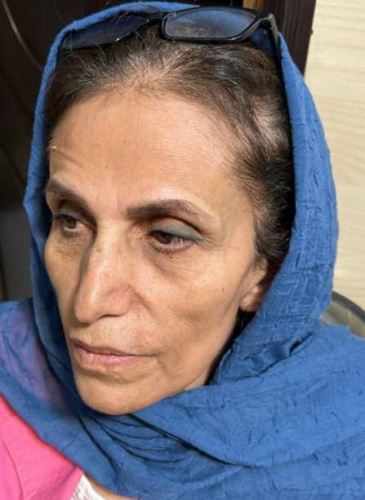 جوان سازی پوست توسط سلول بنیادی