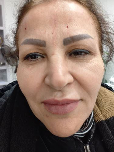 جوانسازی پوست توسط سلولهای بنیادی