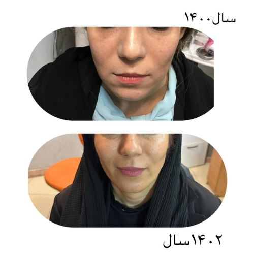 جوانسازی پوست توسط سلولهای بنیادی