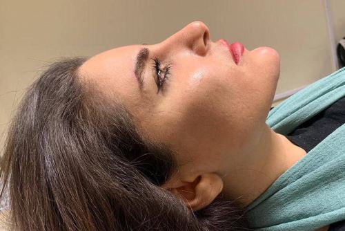 جوانسازی پوست توسط سلولهای بنیادی