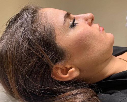 جوانسازی پوست توسط سلولهای بنیادی