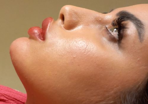 جوانسازی پوست توسط سلولهای بنیادی